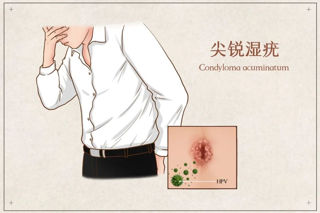 另外,hpv病毒还会影响男性的精子质量,从而增加生育难度.
