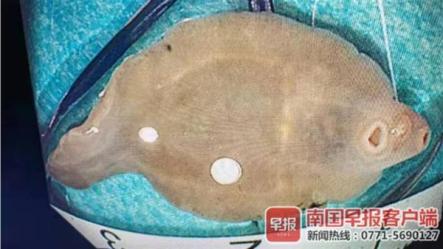 肝脏被虫吃掉三分之一 凶手竟是体内的这条 鱼 湃客 澎湃新闻 The Paper