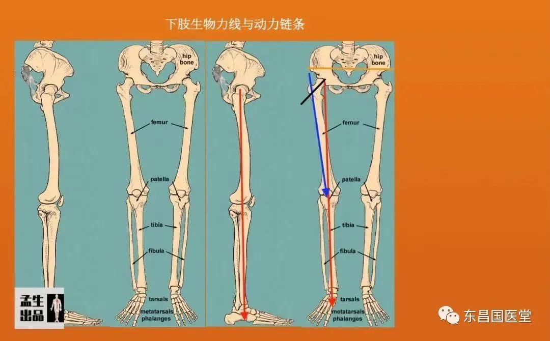 李明講中醫治療膝關節骨性關節炎調攝新思路下肢力線理論