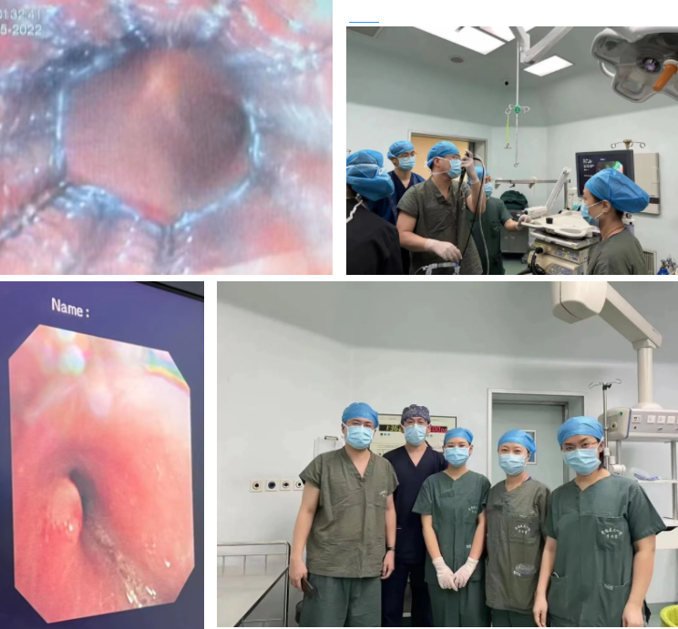 护士怎么数呼吸给生命以奇迹——中国医大一院呼吸危重症团队的元宵节_https://www.jmylbn.com_新闻资讯_第2张