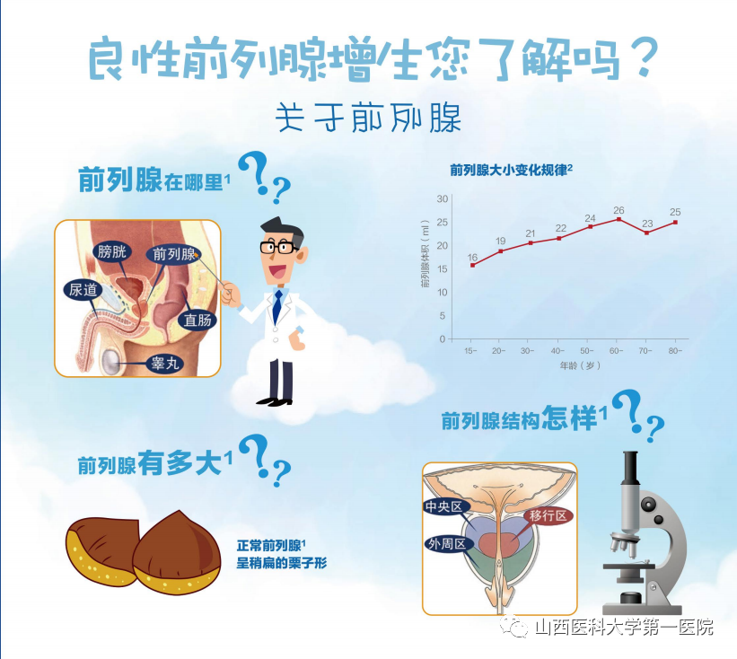 良性前列腺增生疾病图解