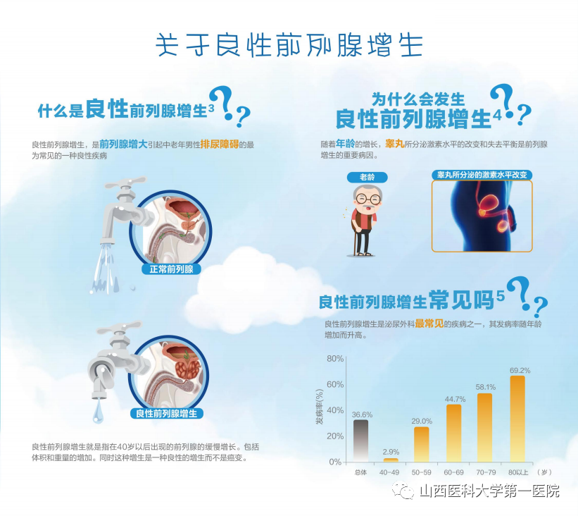 良性前列腺增生疾病图解
