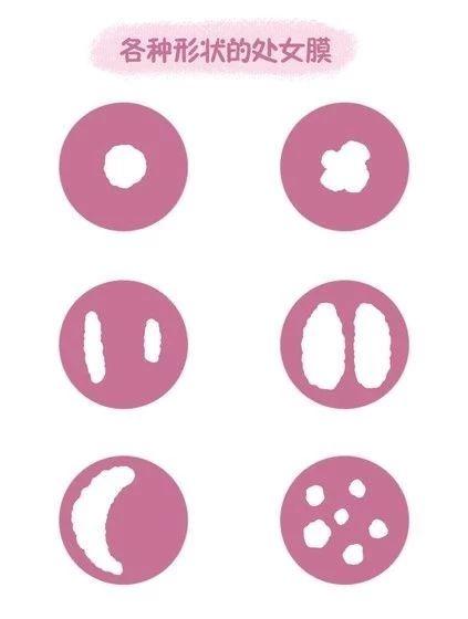 处女膜到底是啥很多人并不知道