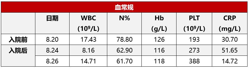 患儿出现发热皮疹伴结膜充血别遗漏了不完全川崎病