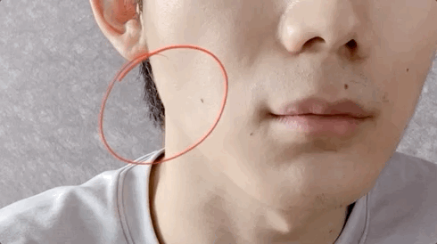 人类发腮不见得是坏事据说可能与长寿有关