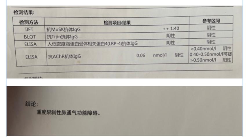 4,肌无力抗体4项:抗musk抗体igg  1:40阳性.