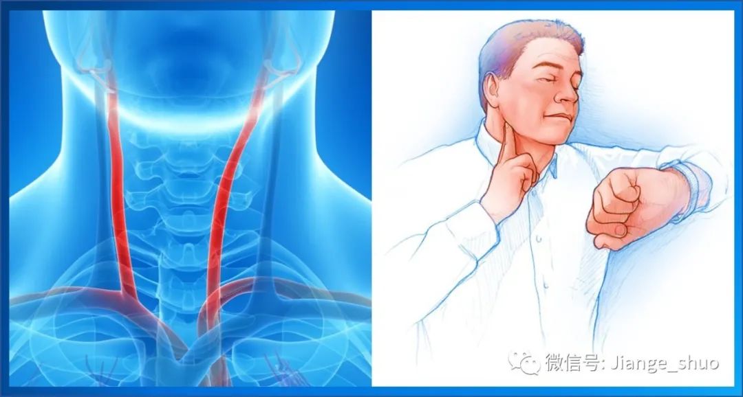 颈动脉怎么摸示意图图片