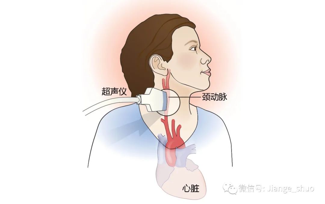 颈动脉做什么检查图片