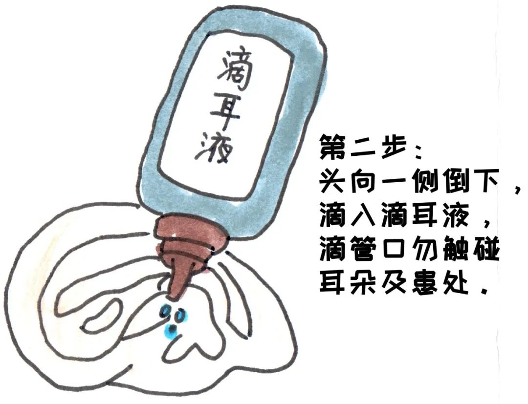 正确的耳浴步骤耳浴主要目的是让耳朵内粘膜在药液中充分浸泡,从而