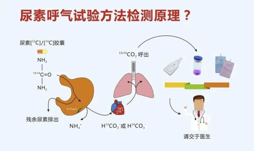 目前临床上最常用方法是碳13,碳14的呼气试验