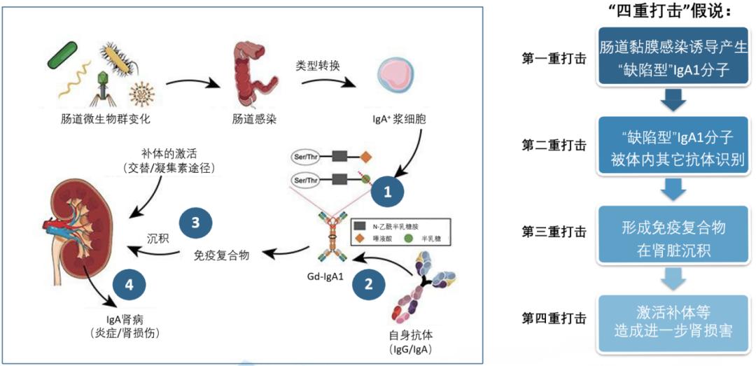 上海腎臟周尋根溯源瞭解iga腎病的發病機制是戰勝疾病的第一步