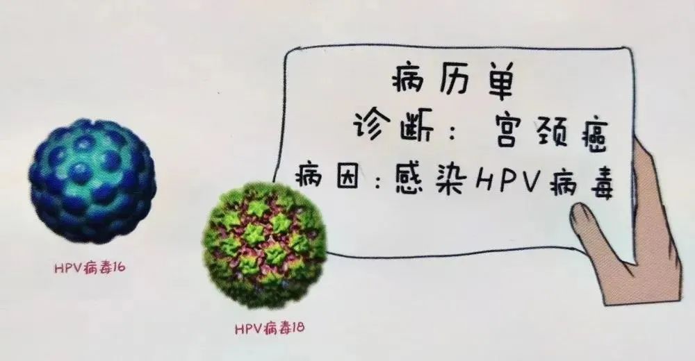 hpv病毒初期症状有哪些图片