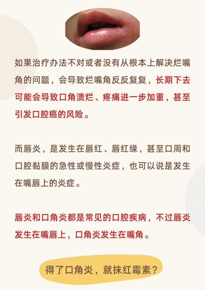 烂嘴角到底是个什么病别不当回事长期不治会增加患癌风险