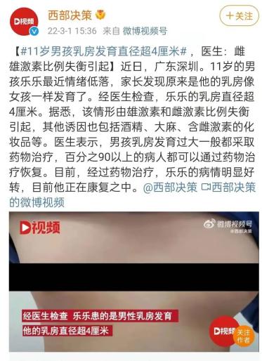 67青春期男孩乳房發育直徑長達4cm是性早熟還是另有原因