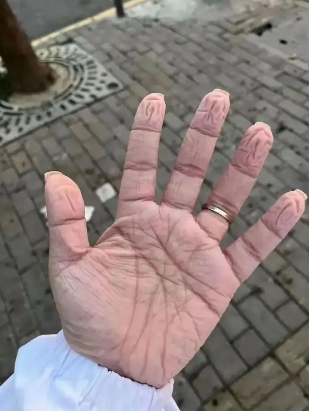 这双奶奶手让人心疼