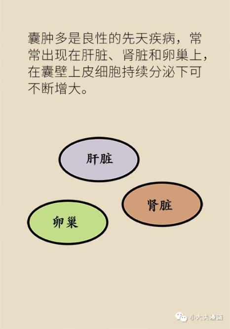 健康科普囊腫息肉結節到底要不要切會不會癌變