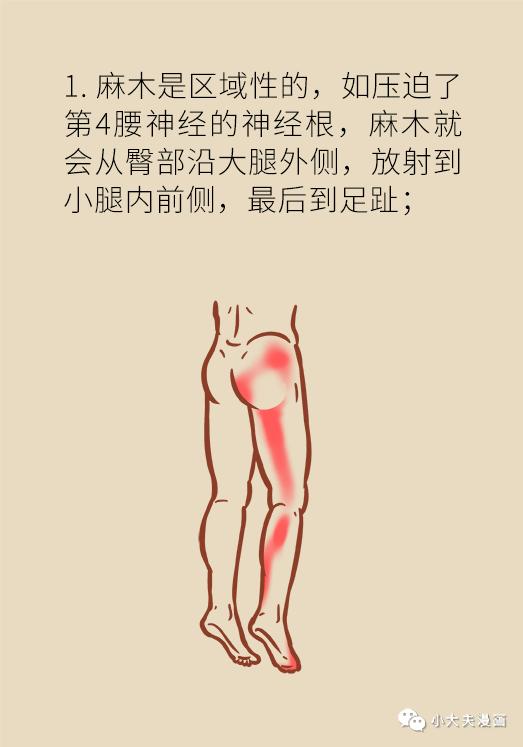 女性腿发麻是大病征兆图片