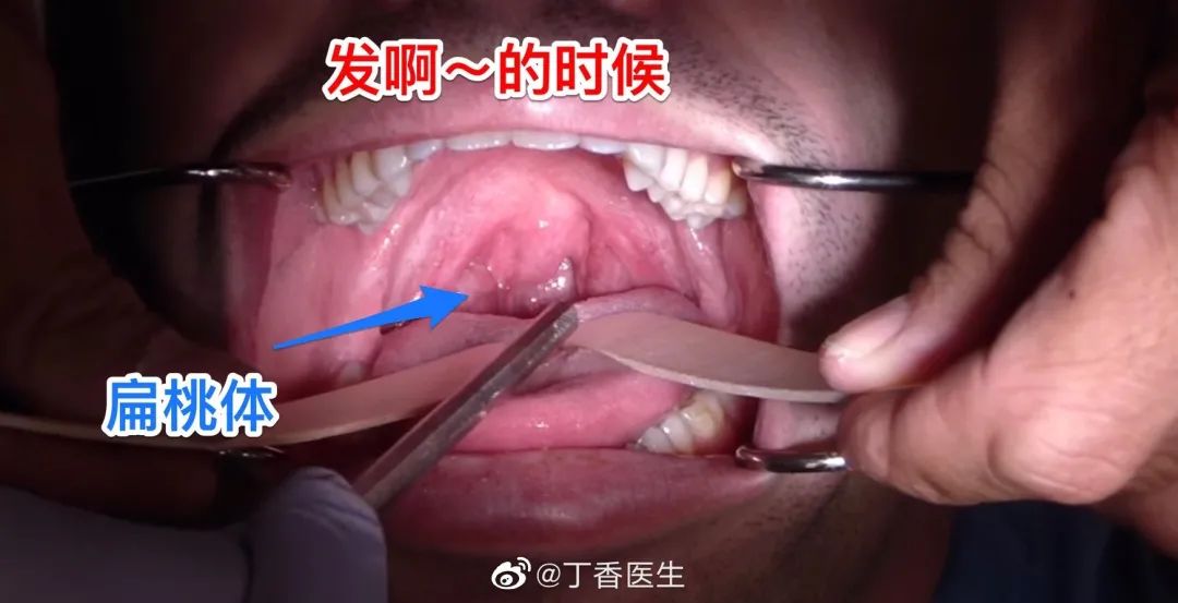 专家说核酸检测不能啊