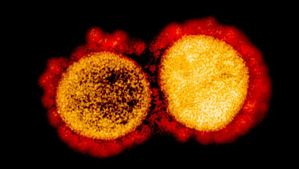 普通冠状病毒，能产生新冠病毒的抗体吗？