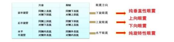 耳石症与中枢性位置性眩晕如何鉴别