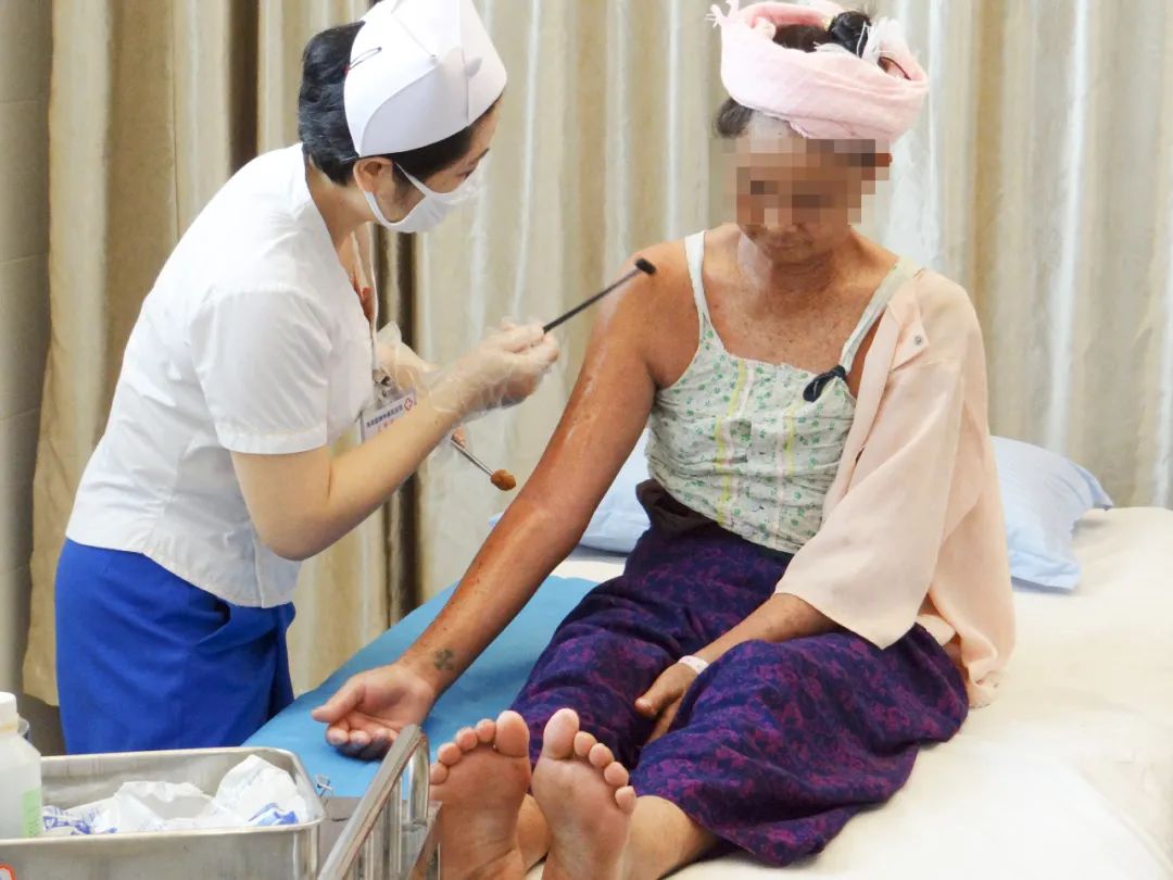 11种傣医疗法纳入医保支付范围傣医药发展再焕新彩