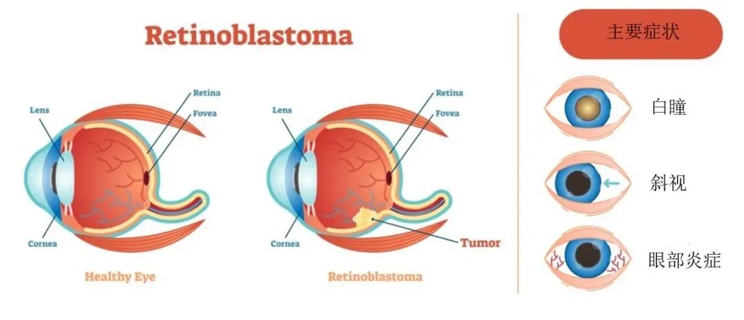 猫眼不可怕这病可怕我们让它不可怕