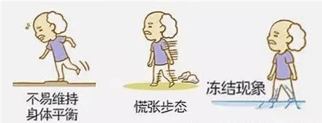 世界帕金森日帕金森病冻结步态是什么