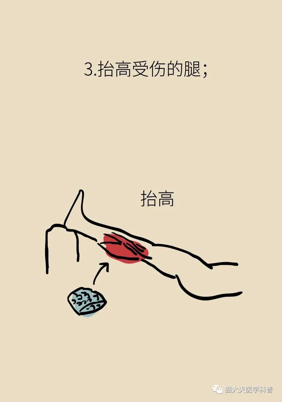 健身容易肌肉拉伤怎样快速缓解