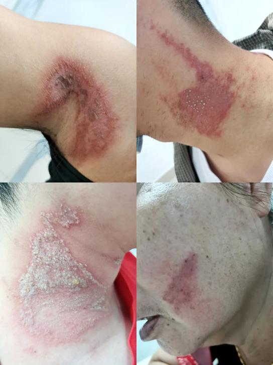 毒性强近期遇到这种虫别拍