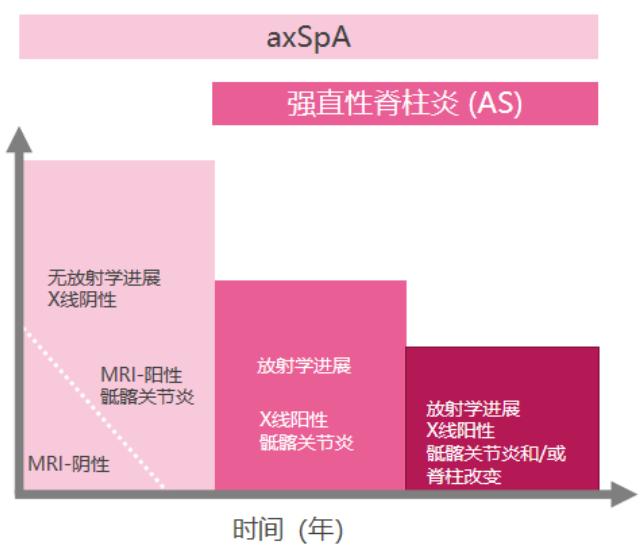 根據國際疾病編碼,目前as為中軸型脊柱關節