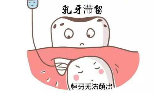 在家拔乳牙小窍门图片