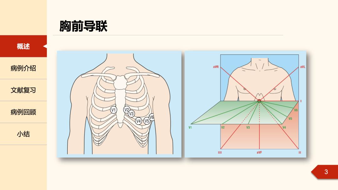 胸导联波形图片