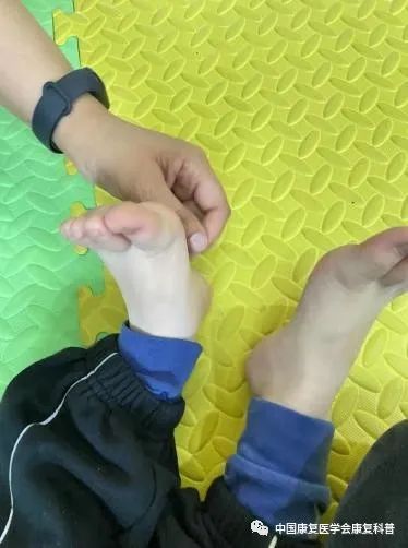 方法:家长用手轻挠手心,脚心或者腋窝等触觉敏感的部位,孩子出现抗拒
