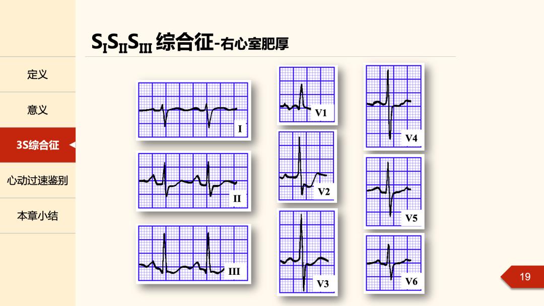 老生常谈丨无人区电轴曾被人遗忘的角落