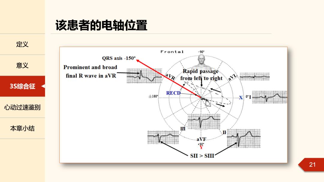 老生常谈丨无人区电轴曾被人遗忘的角落