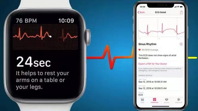Apple Watch向心电图功能精进，苹果精神值得我们学习