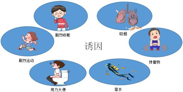 重物,屏气,剧烈运动,剧烈咳嗽,用力解大便后诱发,但多数人无明显诱因