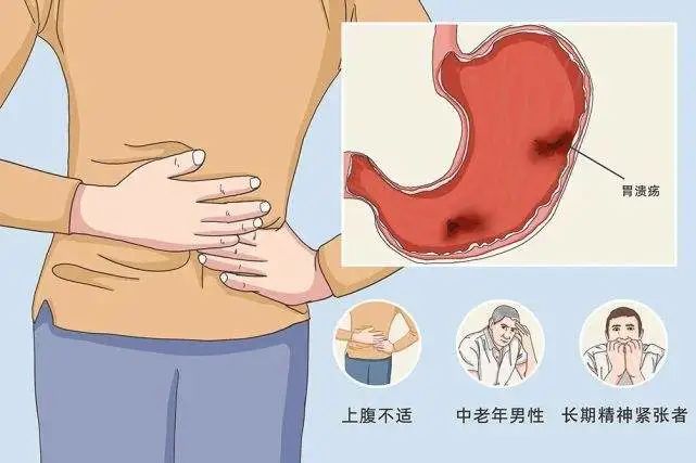 吃完饭以后胃疼可能是