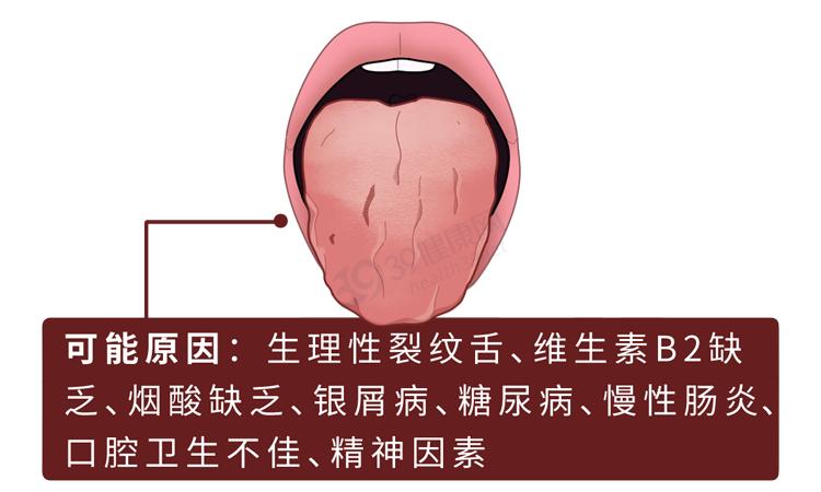 从舌头上抠下来的东西到底有多脏