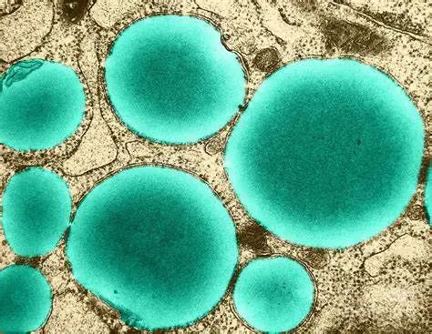 肿瘤"贡献者"脂滴的作用了解,有助于潜在的靶向治疗