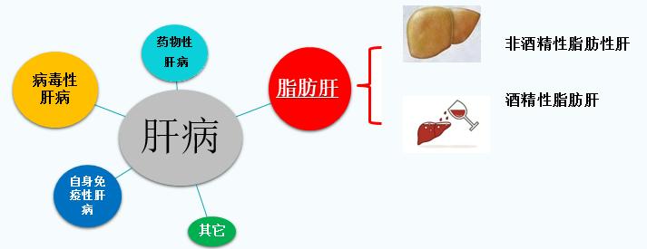 "分支",我的家族中有两位大将,分别是非酒精性脂肪性肝,酒精性脂肪肝