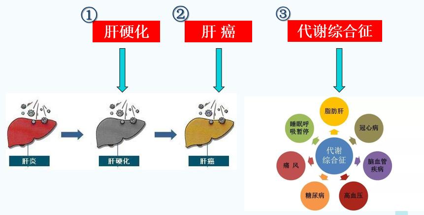 重度脂肪肝的危害图片