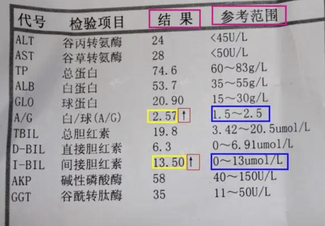 肝功能发生异常,身体也会跟着出现哪些异常表现?