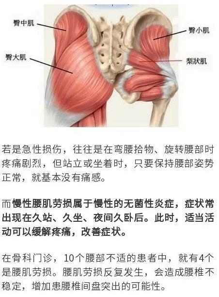 有的人則是在做某些特定動作時腰疼坐著時緩解;有的人站著行走