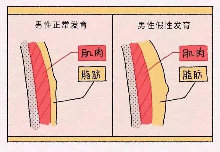 健康科普男人也会长大咪咪