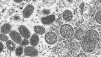 欧美猴痘病毒威胁全球？猴痘到底是什么疾病？