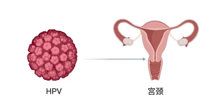 hpv陽性就一定會得宮頸癌如何快速轉陰一篇說透