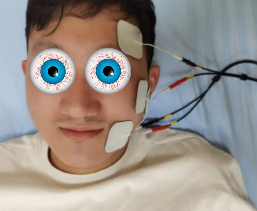 空调吹多导致口眼歪斜?康复科带你认识"贝尔面瘫"