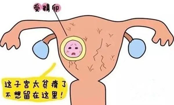 生化妊娠卡通图片