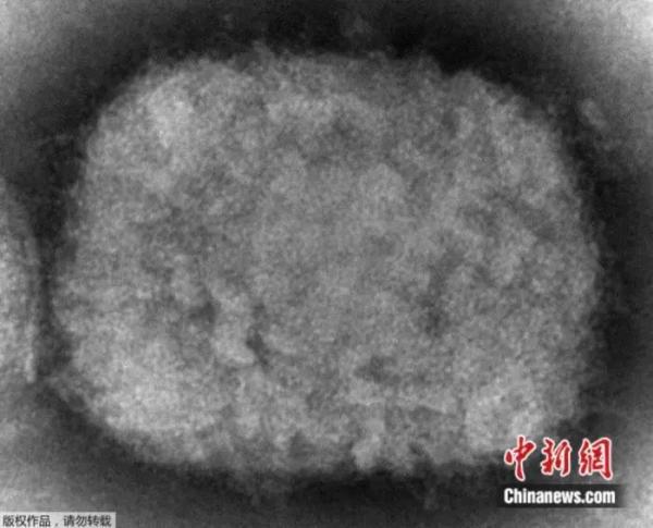 警惕！猴痘病毒已发生人际传播，如何保护自己→